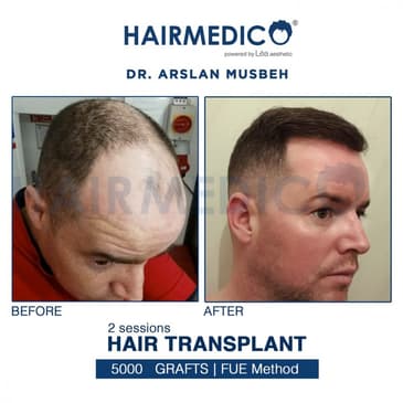 Slider image (3) Hairmedico